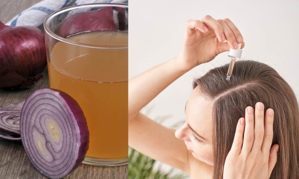 Use Of Onion Juice For Hair Growth!