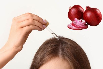 Use Of Onion Juice For Hair Growth!