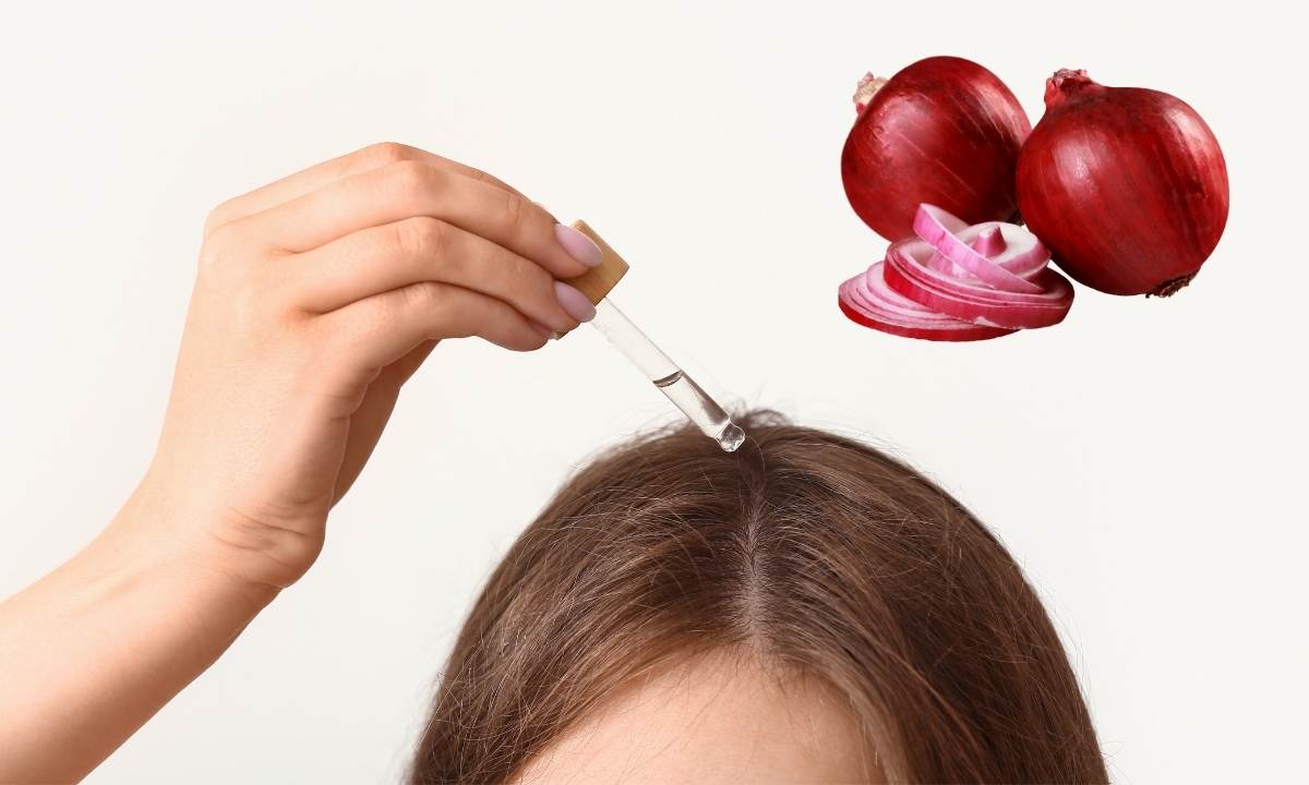 Use Of Onion Juice For Hair Growth!
